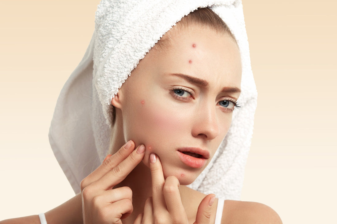 best face wash for acne