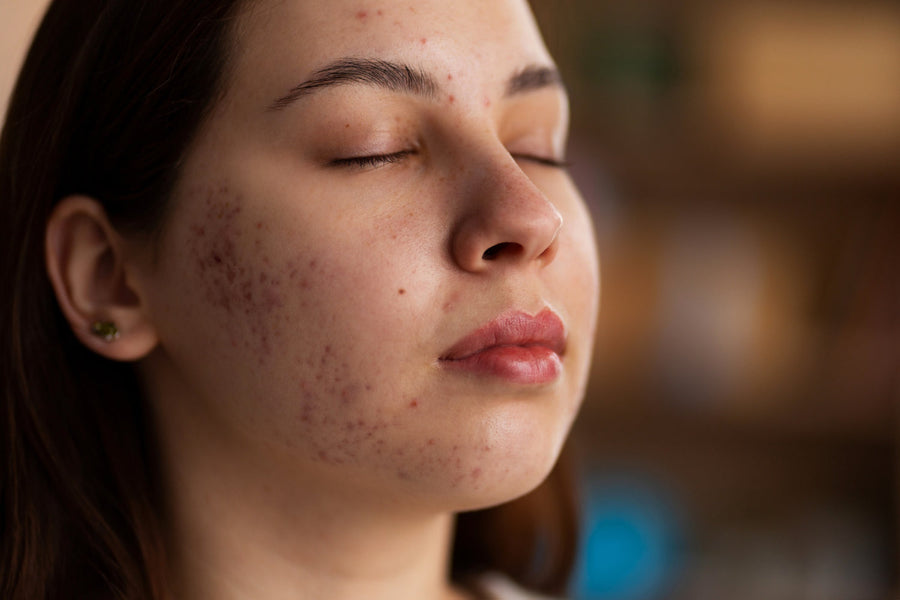 Green Tea face Toner