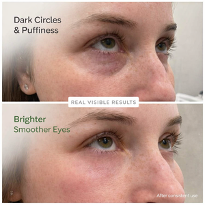 Karrot Cosmetics Under Eye Cream with Retinol & Caffeine | Dark Circle Repair Eye Cream Care | 15ml
