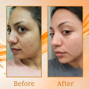 Carrot & Vitamin C Gel Face Wash