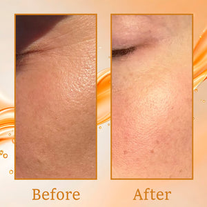 Skin Tightening Range