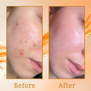 Ubtan & Tea Tree Gel Face Wash