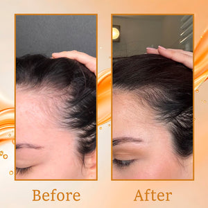 Hair Oil Growth Rosemary