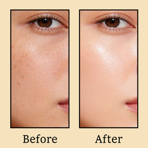 Vitamin C Face Pack